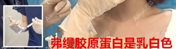 弗缦填充后泪沟没有发白 弗缦填充后泪沟没有发白