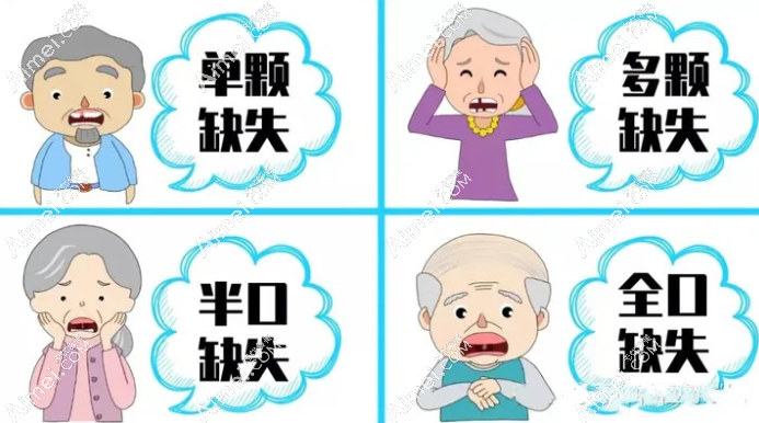 深圳格伦菲尔口腔刘君院长种植牙好不好 深圳格伦菲尔口腔刘君院长种植牙好不好
