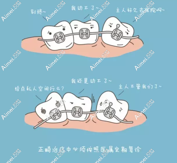 深圳格伦菲尔口腔刘君院长正畸矫正怎么样 深圳格伦菲尔口腔刘君院长正畸矫正怎么样