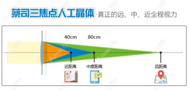 先天性白内障植入三焦晶体优势 先天性白内障植入三焦晶体优势