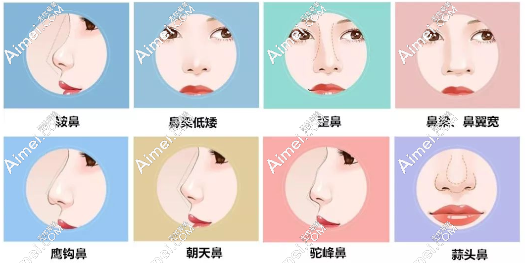 国内高难度鼻修复名医预约挂号方式:李信锋-刘彦军都能预约