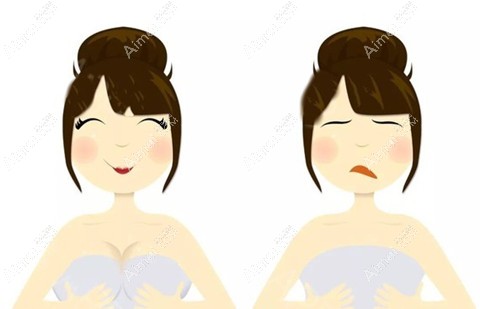 做过缩胸手术的人感言:棒棒糖切口疤痕小,恢复1年也没反弹