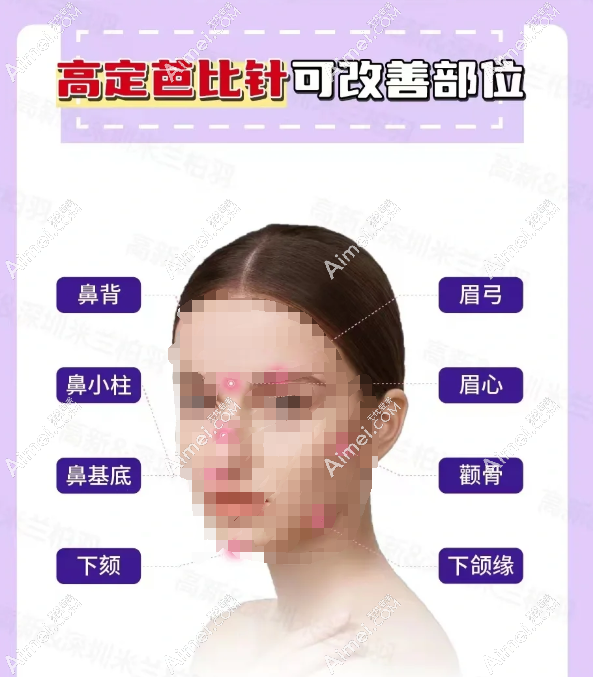 芭比针适合哪些部位