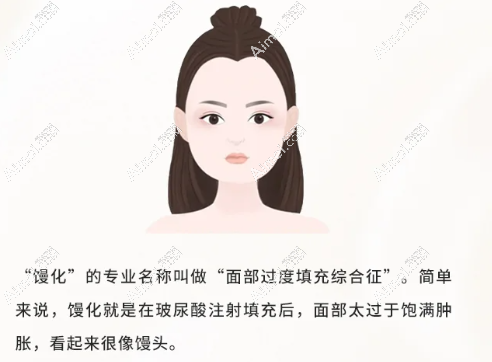 热玛吉、超声炮、溶解针可修复馒化脸 热玛吉、超声炮、溶解针可修复馒化脸