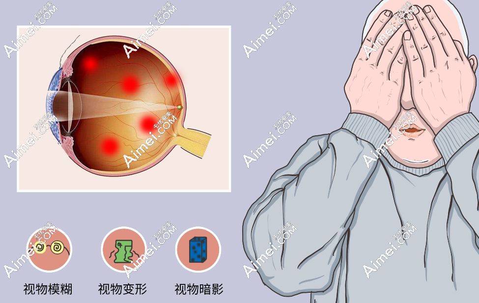 北京民众眼科医院卢宁医生做眼底病好 北京民众眼科医院卢宁医生做眼底病好