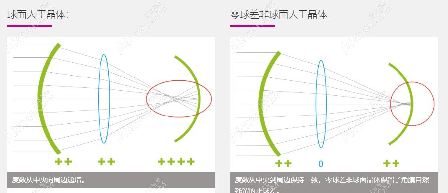 rayner人工晶体573T的优势 rayner人工晶体573T的优势