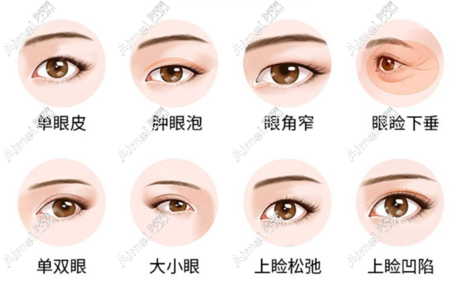 铜陵伊莱美眼整形价格表