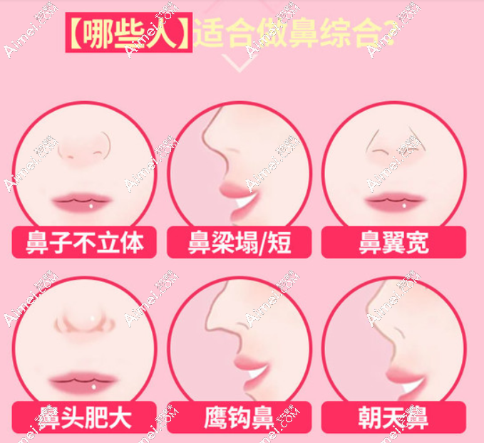 铜陵伊莱美鼻整形价格表