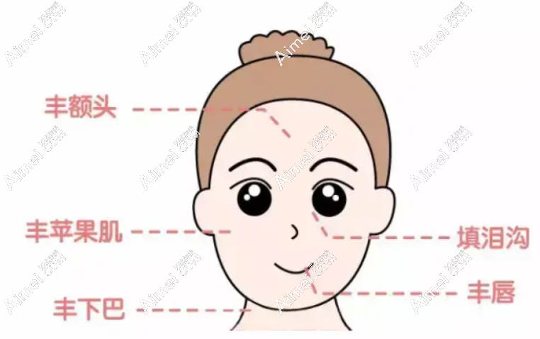 铜陵伊莱美整形玻尿酸注射价格表