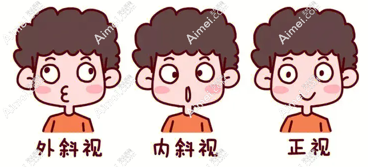 北京民众眼科医院卢炜医生做斜视怎么样 北京民众眼科医院卢炜医生做斜视怎么样