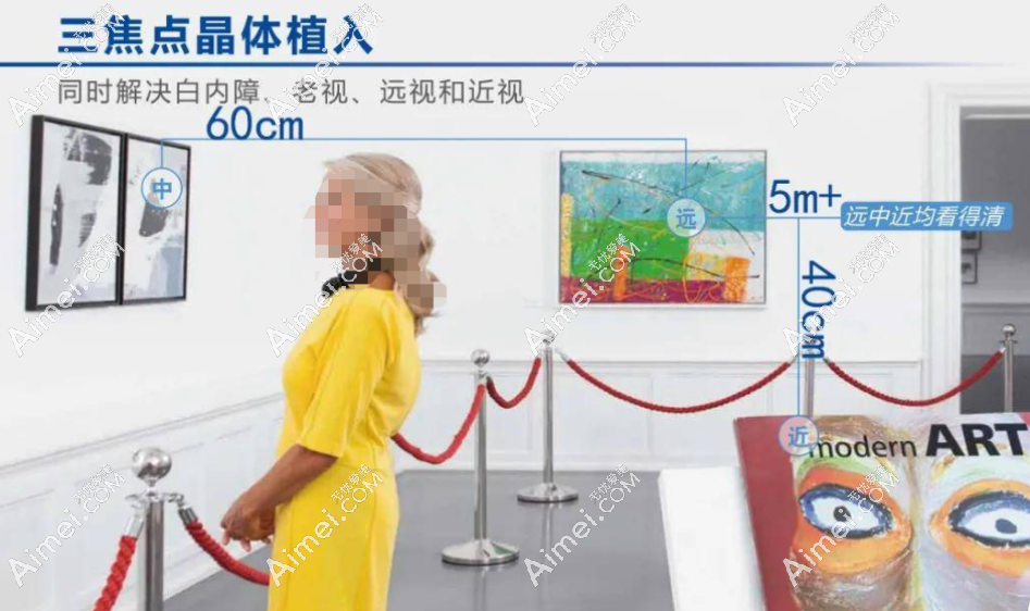 国产三焦晶体植入价格1.8w起,国产的三焦点晶体暂不给报销