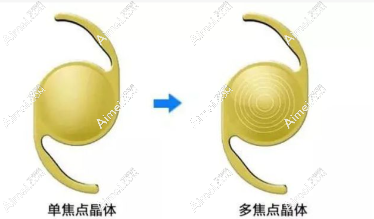 爱尔康sn6at4单焦点非球面人工晶体怎么样 爱尔康sn6at4单焦点非球面人工晶体怎么样