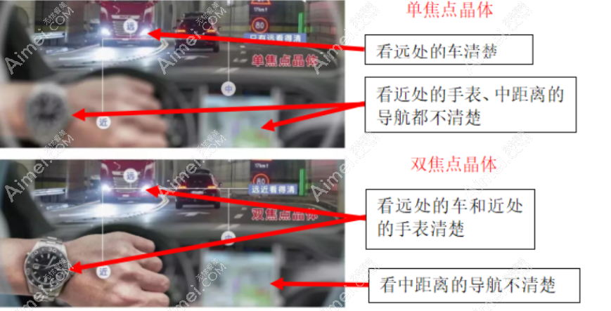 爱尔康单焦非球面人工晶体有哪些型号 爱尔康单焦非球面人工晶体有哪些型号