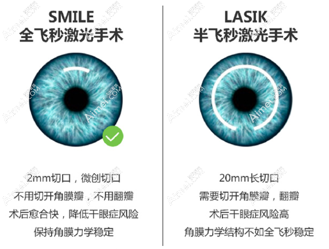 南昌爱尔眼科近视手术收费不贵 南昌爱尔眼科近视手术收费不贵