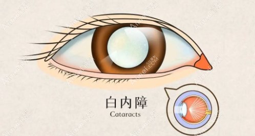 大连华厦眼科医院院长周明简历