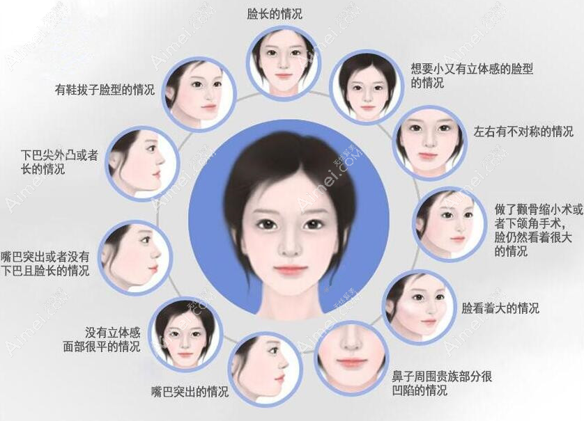 何锦泉偏颌手术做的好-附广州广大医院何锦泉医生门诊时间