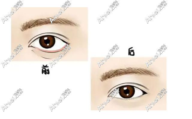 20231116637035.png image.png