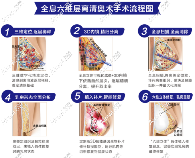 广州荔湾区医院取注射异物干净创伤小 广州荔湾区医院取注射异物干净创伤小