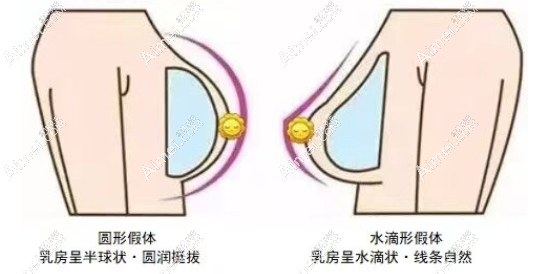 广州正规丰胸医院技术好