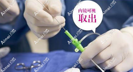 广州荔湾区齐云香清奥技术好 广州荔湾区齐云香清奥技术好
