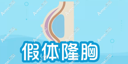广州出名的丰胸医院排名前10技术好