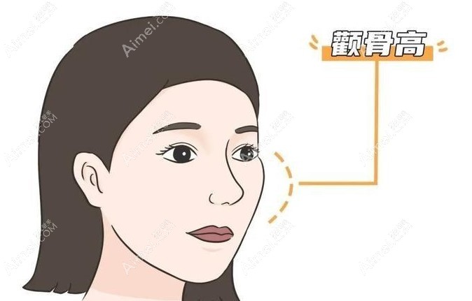 张立天颧骨磨骨实例dlren.com 张立天颧骨磨骨实例dlren.com