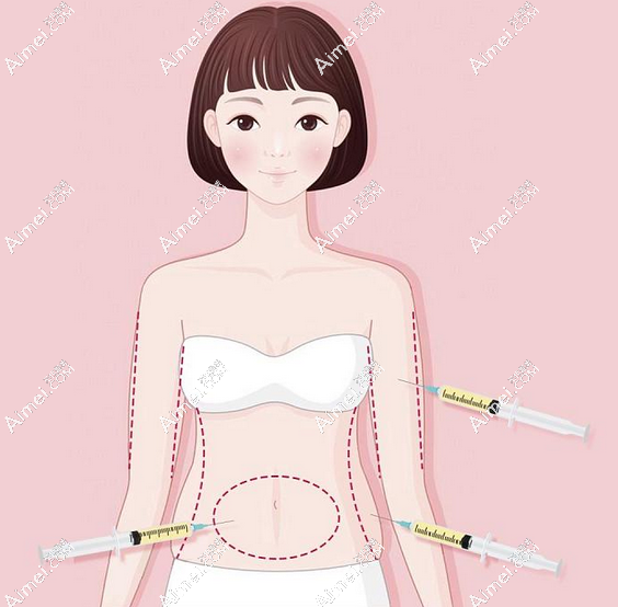 怎么联系梁耀婵舒适吸脂?在北京有名通过电话面诊梁耀婵抽脂团队更快