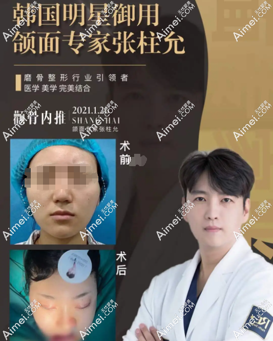 张柱允磨骨技术怎么样 张柱允磨骨技术怎么样