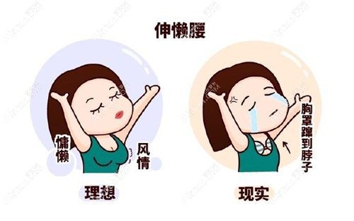 不要托，说说北京董岩岩医生隆胸怎么收费？大家做的曼托还是傲诺拉？