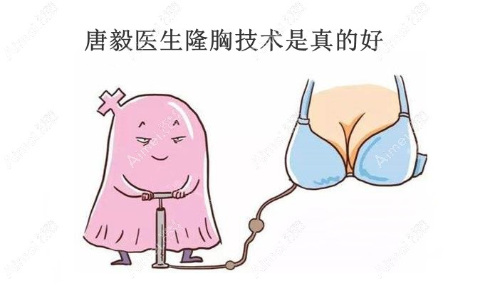 买噶,找唐毅医生隆胸技术好没翻车!给我做的假体隆胸大小一样必须好评