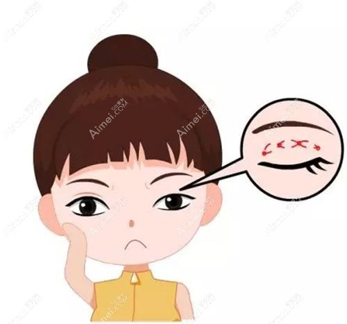 刘志刚修复双眼皮当然行,手术无差评,和杜园园都是金刀奖名医
