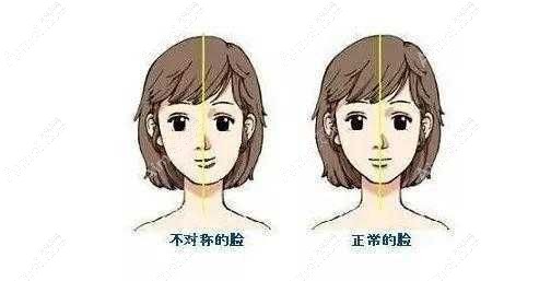 王涛正颌手术在重庆松山医院,王涛正颌有专有技术截骨量少风险小预约不亏
