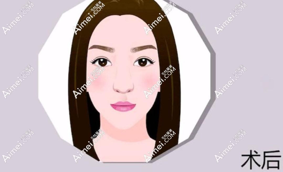 北京加减美穆宝安面部提升 北京加减美穆宝安面部提升