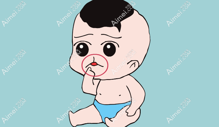 唇腭裂需要做几次手术 唇腭裂需要做几次手术