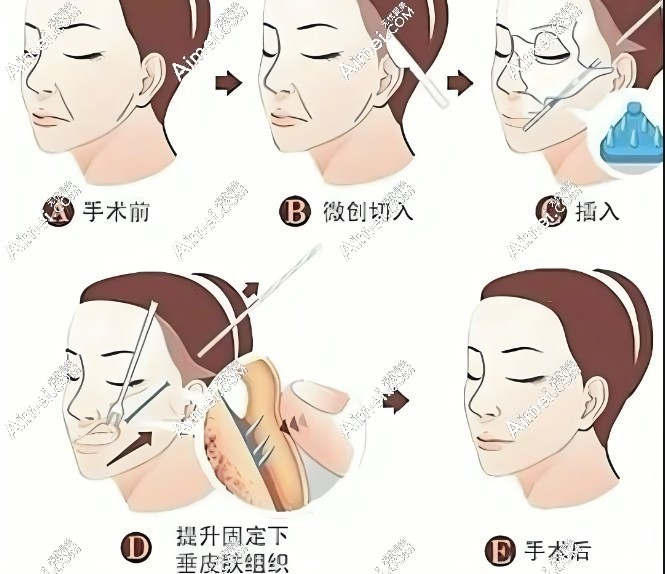 黄寅守医生V3/V6/V9价格与成效全解析 黄寅守医生V3/V6/V9价格与成效全解析