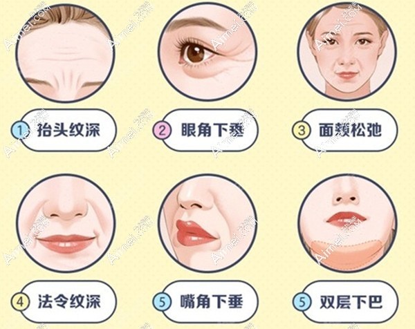 面部需要做提升手术的情况dlren.com 面部需要做提升手术的情况dlren.com