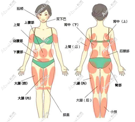 国内威塑吸脂医院哪家好?威塑抽脂vaser官网认证医师名单梳理