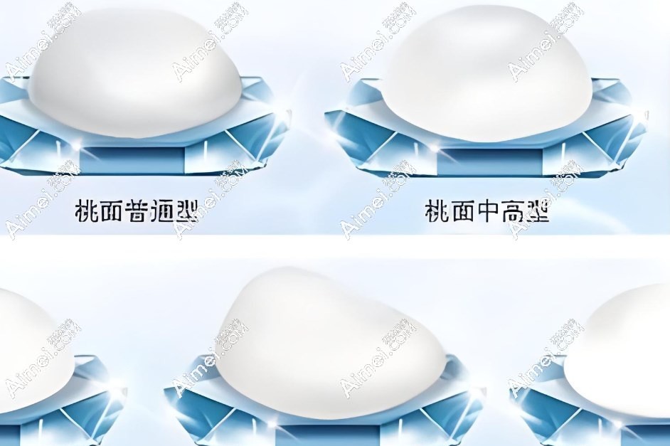 假体隆胸医院推荐
