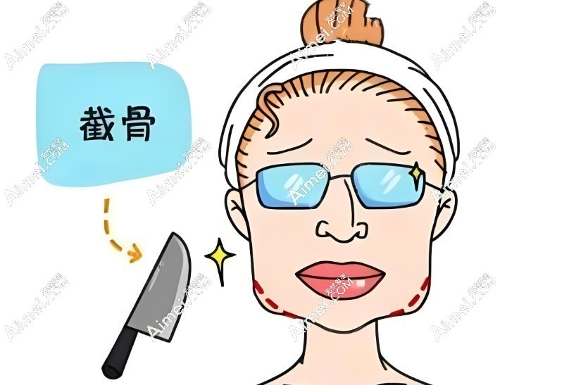 北京张笑天医生磨骨风格自然 北京张笑天医生磨骨风格自然