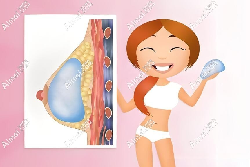 假体隆胸医生推荐dlren.com 假体隆胸医生推荐dlren.com