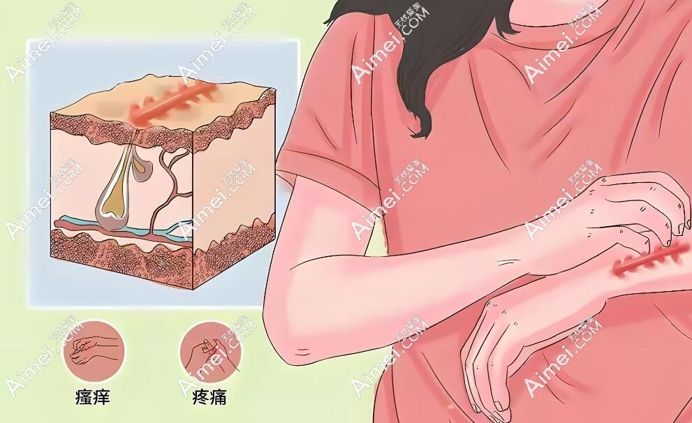 各种疤痕修复dlren.com 各种疤痕修复dlren.com