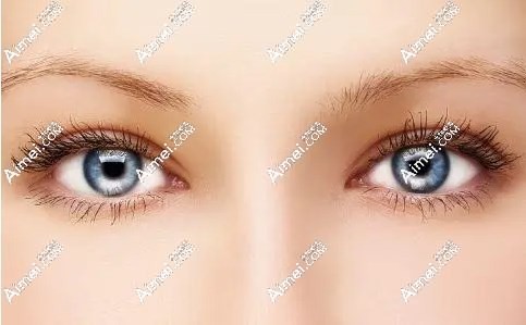 杜园园双眼皮修复事例 杜园园双眼皮修复事例