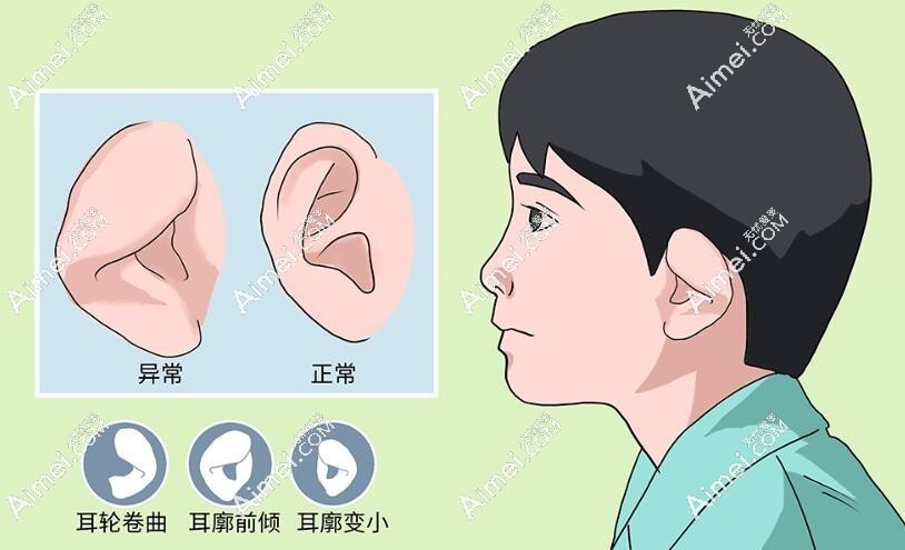 小儿畸形矫正术dlren.com 小儿畸形矫正术dlren.com