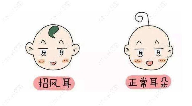 西安耳朵整形需要多少钱?www.dlren.com 西安耳朵整形需要多少钱?www.dlren.com
