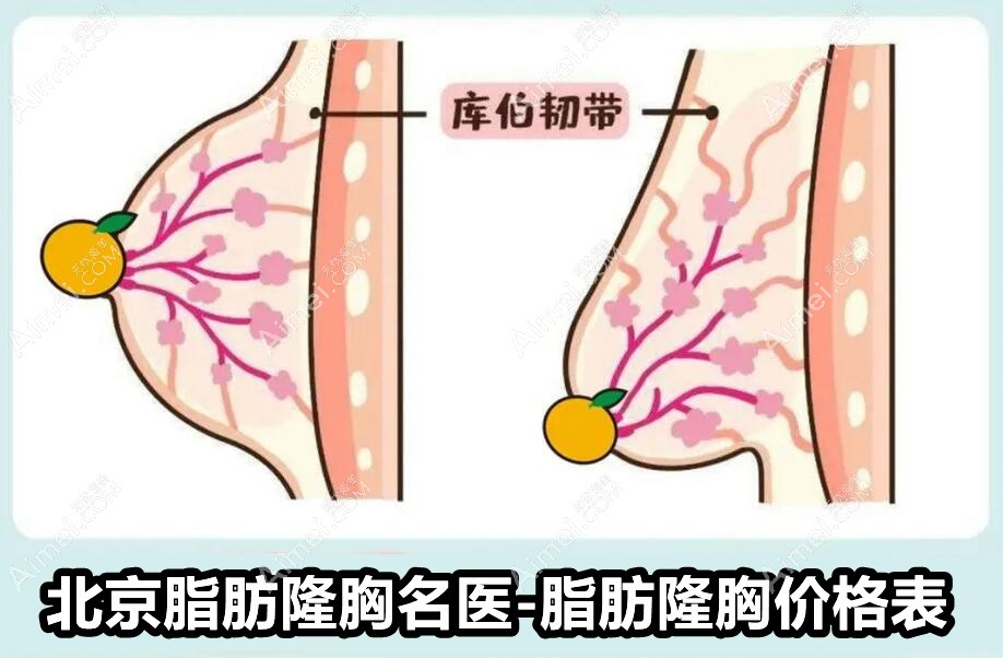 北京脂肪隆胸有名的医生有:王明利、刘成胜、冯斌、乔爱军、梁耀婵等热门人物