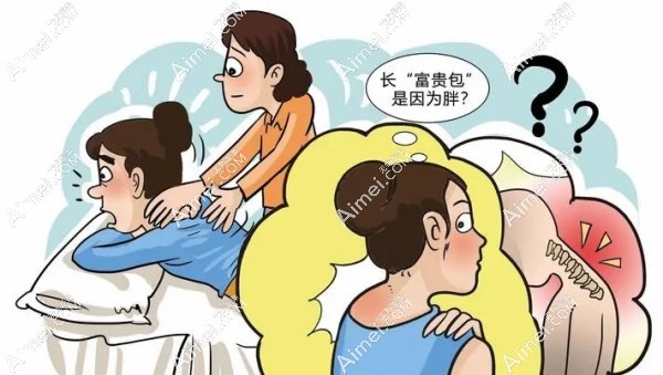 富贵包抽脂好还是切除好