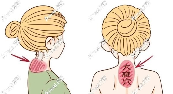 富贵包是不是脂肪堆积dlren.com