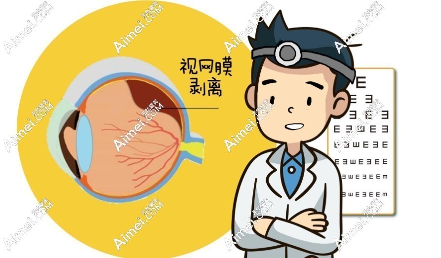 北京视网膜脱落手术医院排名靠前一 北京视网膜脱落手术医院排名靠前一