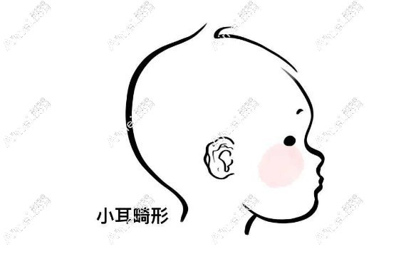 国内小耳畸形矫正名医大盘点:实力排名\坐诊医院及所在地区全解析