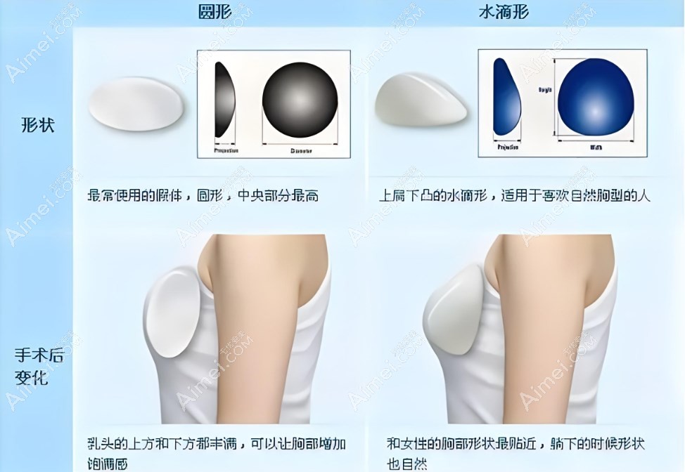 深圳做假体隆胸 深圳做假体隆胸